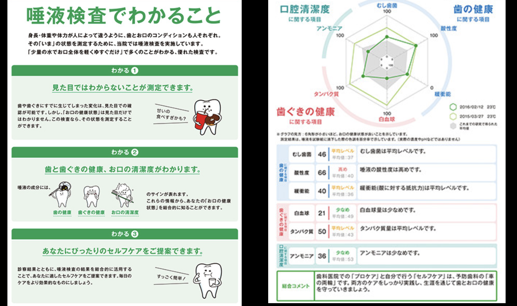 摂津市(千里丘)の歯医者、ひろ歯科の予防歯科